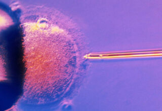 Những điều cần biết về thụ tinh trong ống nghiệm