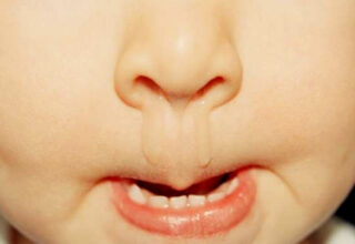 Nhìn dịch mũi đoán bệnh