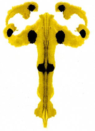 Bài trắc nghiệm tâm lý Hermann Rorschach