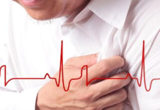 "Thời gian vàng" cấp cứu người nhồi máu cơ tim